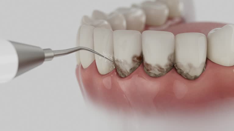Trusted Dental Crowns And Bridges service in Villa Park, IL - Dentist Open Now